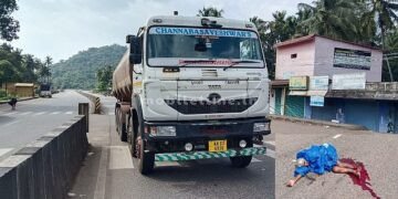 A lorry wheel that has been mounted on both legs!