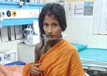 Husband suspected his wife of cheating: Poor thing burned in fire!