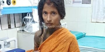 Husband suspected his wife of cheating: Poor thing burned in fire!