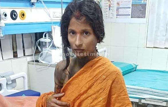 Husband suspected his wife of cheating: Poor thing burned in fire!