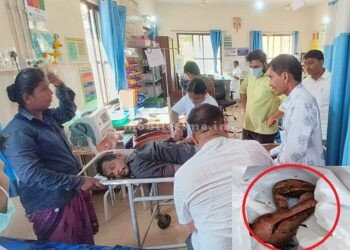 He came to the hospital with a snake bite in his hand!