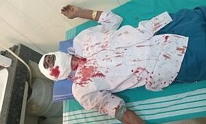 A bloody revolution for the right to worship!