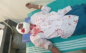 A bloody revolution for the right to worship!