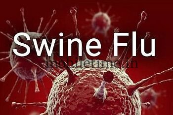 A person from Yellapur has died from swine flu!