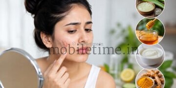 ಮೊಡವೆ ಕಲೆಗಳಿಗೆ ಮನೆಯಲ್ಲೇ ಸರಳ ಪರಿಹಾರ