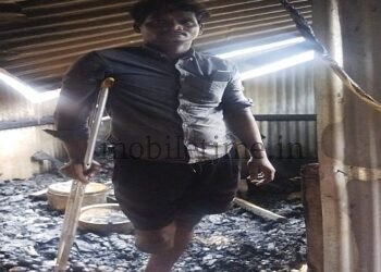 Shocking blow to a differently-abled person's shop Artificial leg charred!