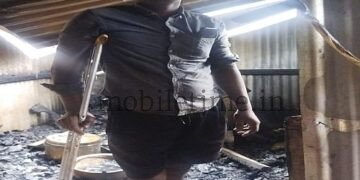 Shocking blow to a differently-abled person's shop Artificial leg charred!
